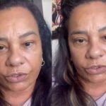 Solange Couto enfrenta problemas de saúde e pode faltar à final do BBB 26